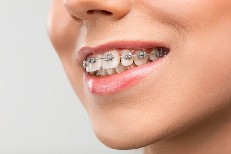 Smile Design Clinic photo 4
