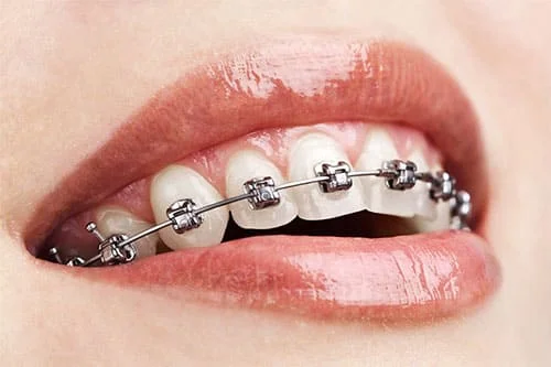 ALUER AESTHETIC & DENTAL CLINIC L.L.C photo 1