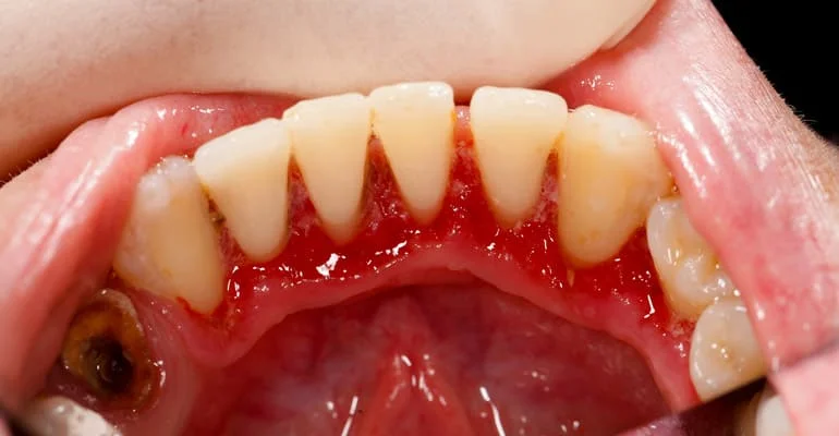 ALUER AESTHETIC & DENTAL CLINIC L.L.C photo 2