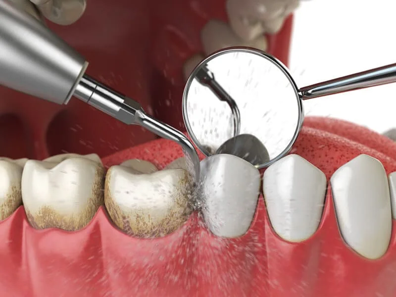 ALUER AESTHETIC & DENTAL CLINIC L.L.C photo 3