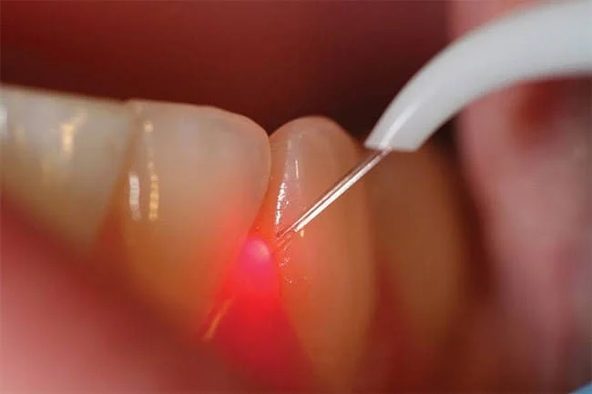 ALUER AESTHETIC & DENTAL CLINIC L.L.C photo 4