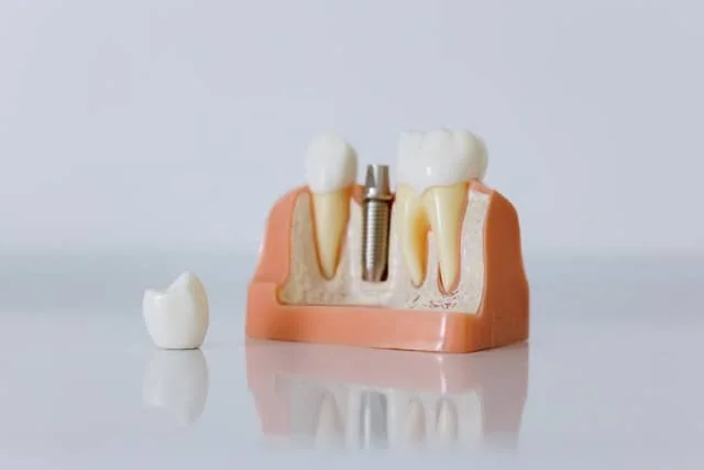 ARIES DENTAL AND AESTHETIC CLINIC L.L.C photo 2