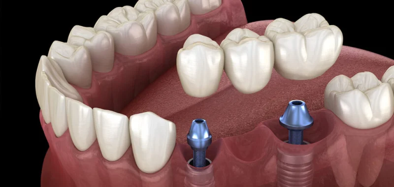 ARIES DENTAL AND AESTHETIC CLINIC L.L.C photo 3