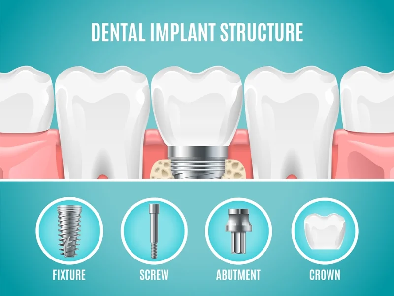 ARIES DENTAL AND AESTHETIC CLINIC L.L.C photo 4