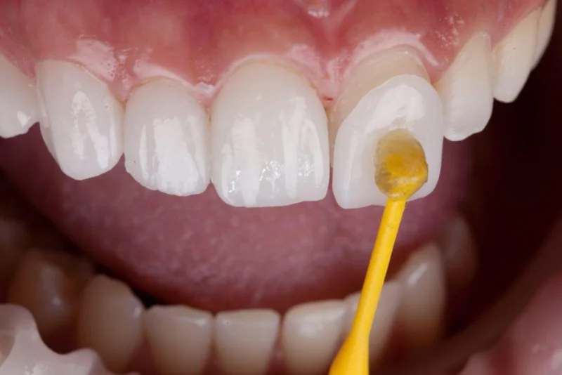 ARIES DENTAL AND AESTHETIC CLINIC L.L.C photo 5
