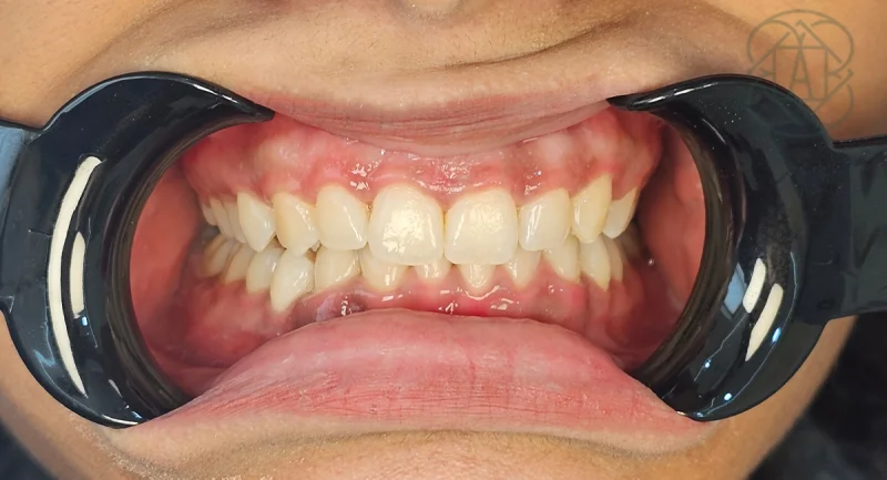 ARIES DENTAL AND AESTHETIC CLINIC L.L.C photo 6
