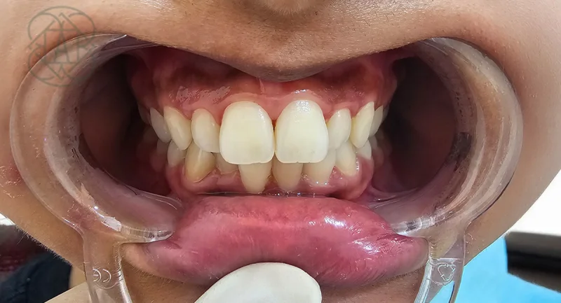 ARIES DENTAL AND AESTHETIC CLINIC L.L.C photo 7