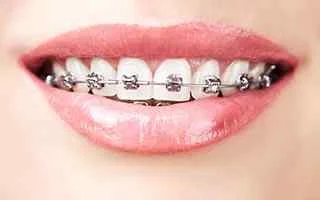 Avance Dental Clinic LLC (Branch photo 3