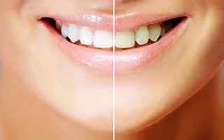 Avance Dental Clinic LLC (Branch photo 4