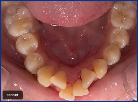 Avance Dental Clinic LLC (Branch photo 8