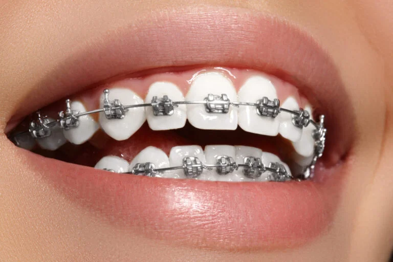 Babylon Dental Center L.L.C photo 8