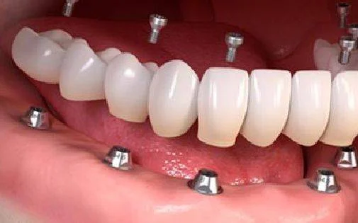 Bay Avenue Dental Centre photo 2