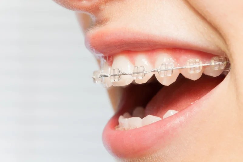 BEYOND 32 DENTAL AND MEDICAL CLINIC L.L.C photo 8