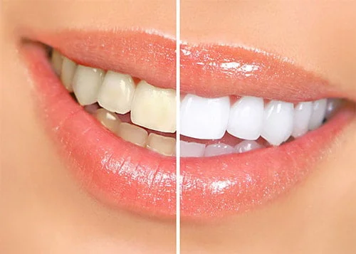 SEJOVI DENTAL & IMPLANT CENTER DMCC photo 3