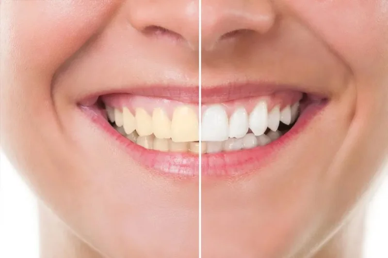 SEJOVI DENTAL & IMPLANT CENTER DMCC photo 5