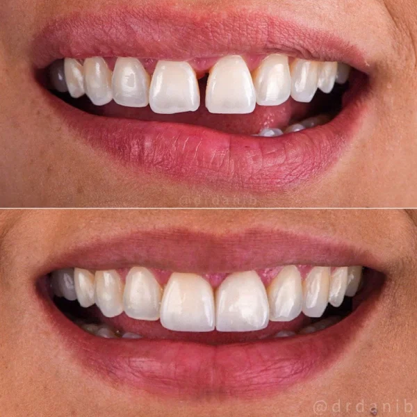 SEJOVI DENTAL & IMPLANT CENTER DMCC photo 7