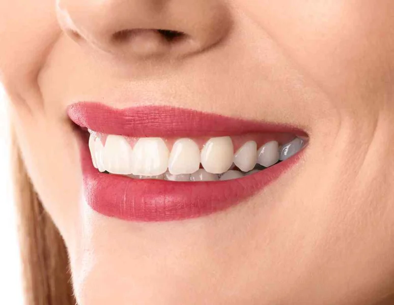 DR HALA ALSAKKA DENTAL CLINIC L.L.C photo 8