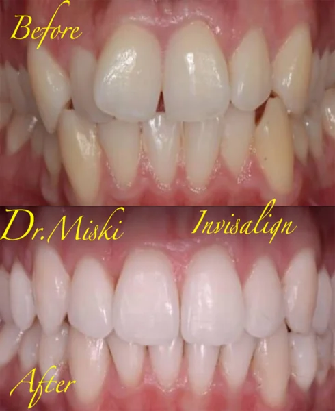 DR MISKIS DENTAL AESTHETIC CENTRE DMCC photo 2