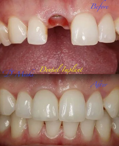 DR MISKIS DENTAL AESTHETIC CENTRE DMCC photo 4