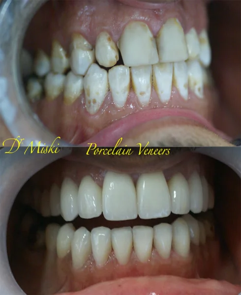 DR MISKIS DENTAL AESTHETIC CENTRE DMCC photo 5