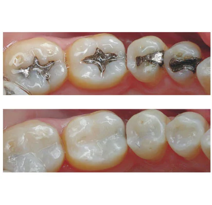 DR MISKIS DENTAL AESTHETIC CENTRE DMCC photo 6