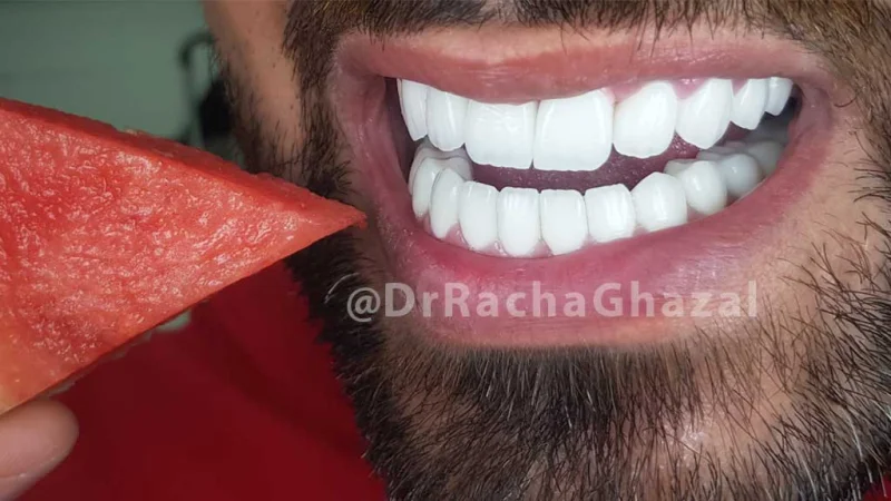 Dr Racha Ghazal Cosmetic Dentistry LLC photo 3