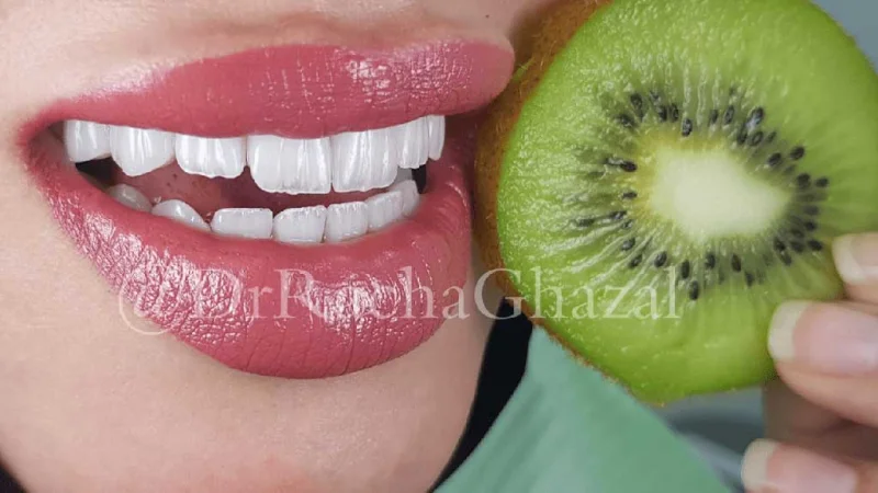 Dr Racha Ghazal Cosmetic Dentistry LLC photo 6