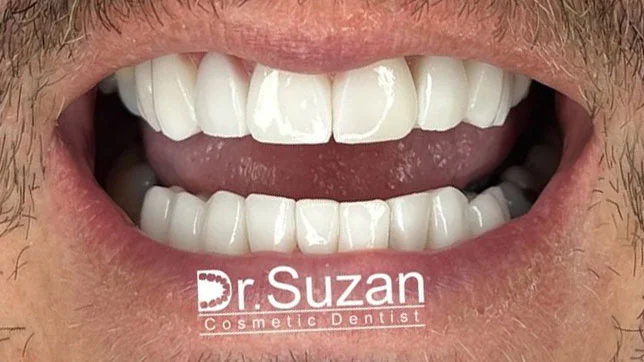 DR SUZAN ASSARIAN DENTAL CLINIC LLC photo 4