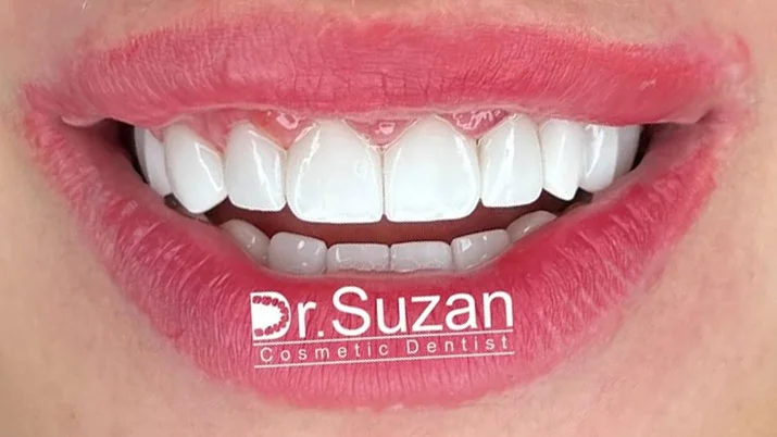 DR SUZAN ASSARIAN DENTAL CLINIC LLC photo 6