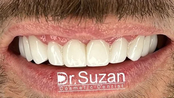 DR SUZAN ASSARIAN DENTAL CLINIC LLC photo 8