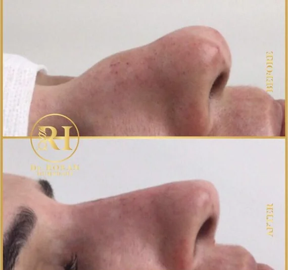 Drrosan Humydani Dermatology Andbeauty Clinic LLC photo 3