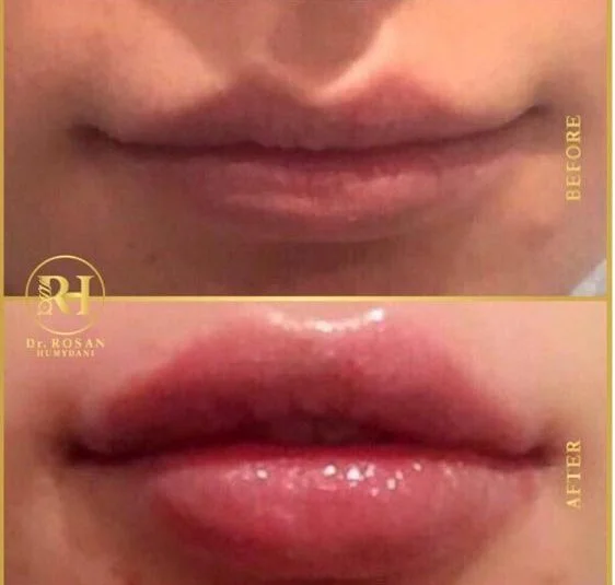 Drrosan Humydani Dermatology Andbeauty Clinic LLC photo 4