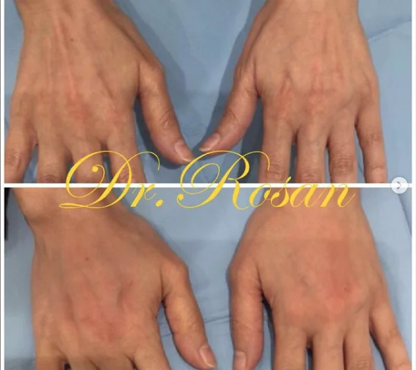 Drrosan Humydani Dermatology Andbeauty Clinic LLC photo 5