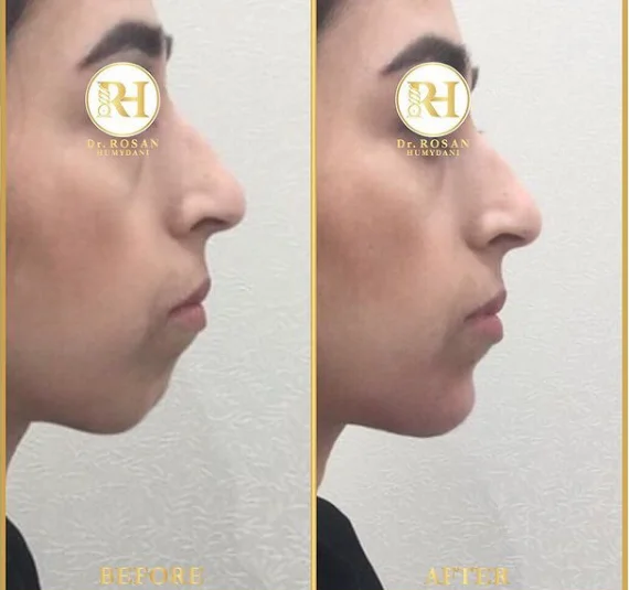 Drrosan Humydani Dermatology Andbeauty Clinic LLC photo 6