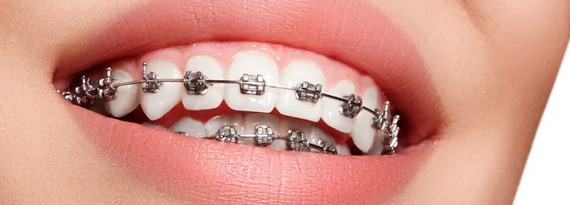 FACTOR SMILE CLINIC L.L.C photo 7
