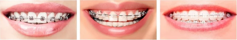 FACTOR SMILE CLINIC L.L.C photo 8