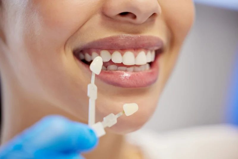Floraison Dental Clinic LLC photo 7