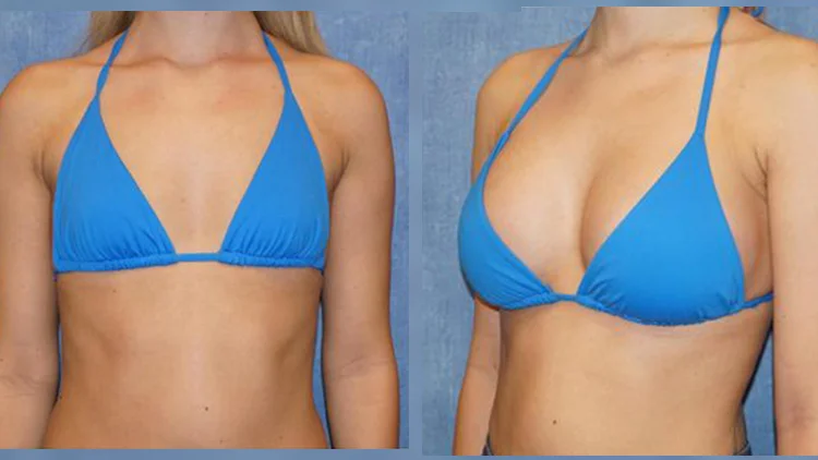GENTLEMAX CLINICS LLC photo 8