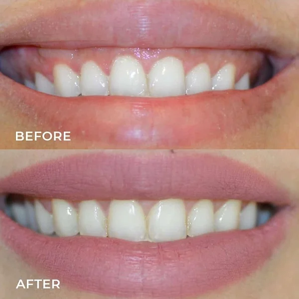 Dr Aburas Dental Center L.L.C photo 5