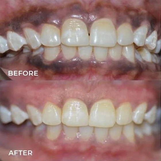Dr Aburas Dental Center L.L.C photo 8