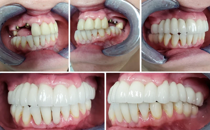 JESH AND MIKH DENTAL CLINIC photo 6