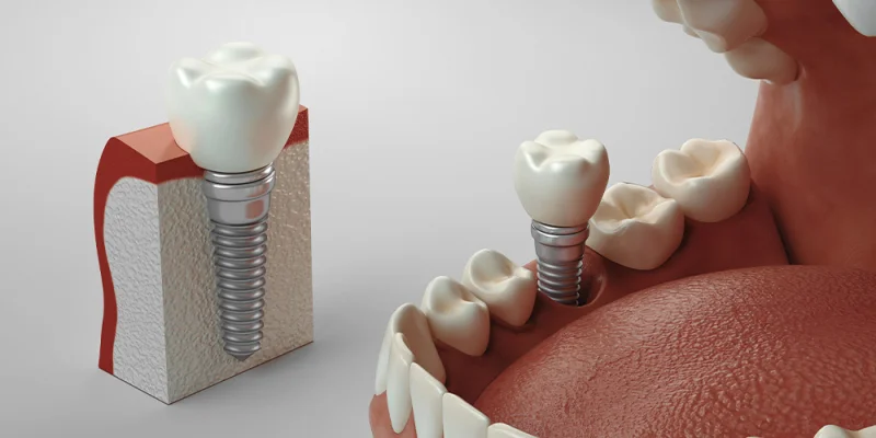 Sahara Dental Clinic And Orthodontic Centre LLC photo 3