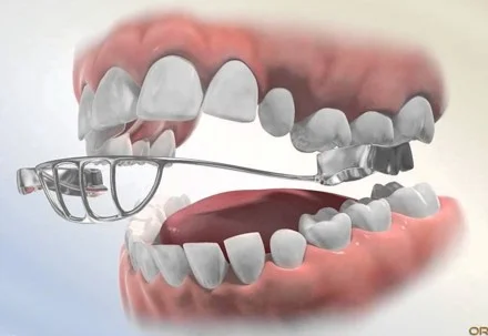 Munich Dental Clinic Branch photo 7