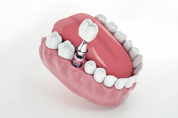 Nagem Dental Diet And Laser Center Llc Branch photo 3