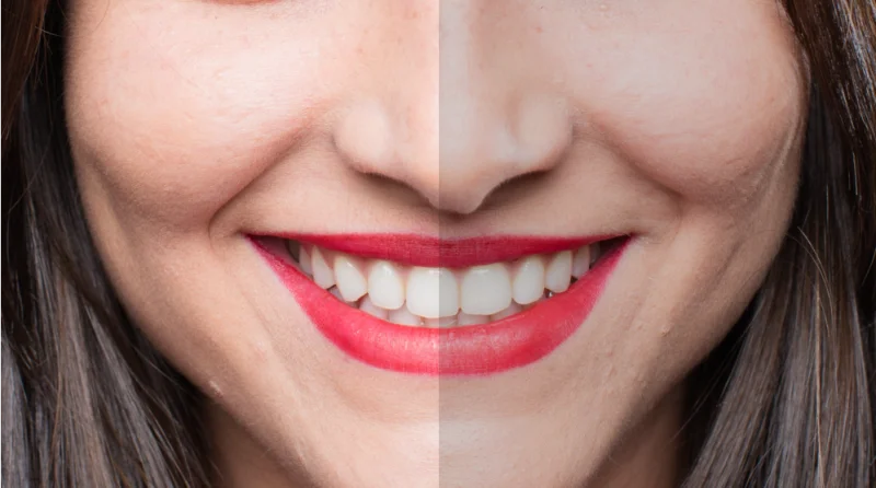 Nava Dental Care LLC photo 5