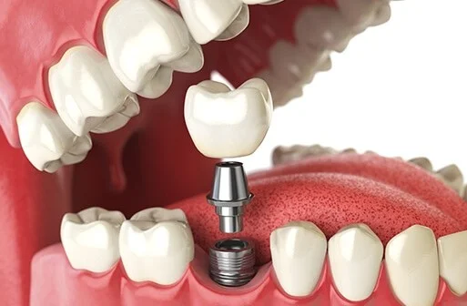 New Ivory Dental And Implant Clinic LLC photo 1