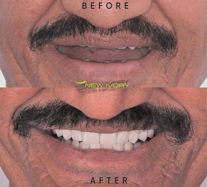 New Ivory Dental And Implant Clinic LLC photo 2