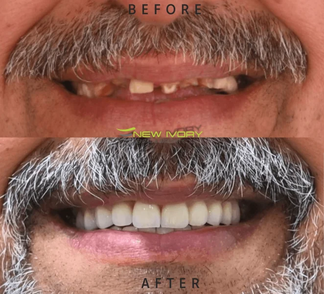 New Ivory Dental And Implant Clinic LLC photo 3
