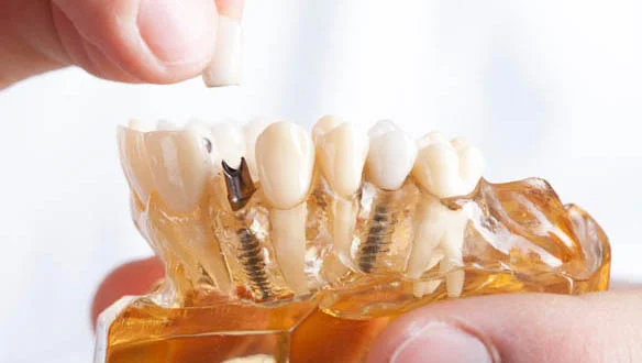 New Ivory Dental And Implant Clinic LLC photo 5