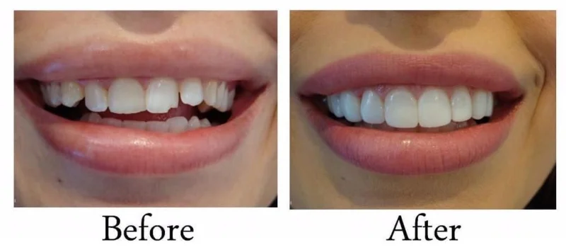 Avance Dental Clinic LLC (Branch photo 2